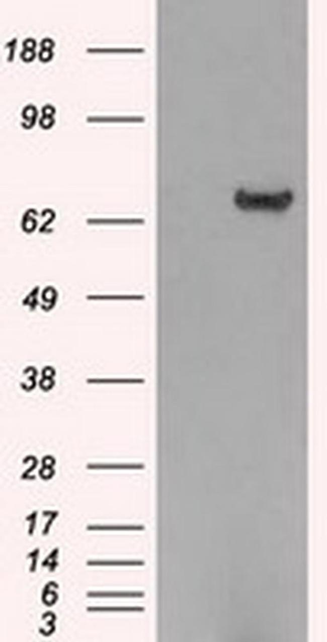 HDAC10 Antibody in Western Blot (WB)