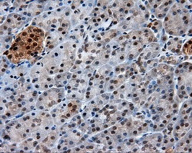 GBE1 Antibody in Immunohistochemistry (Paraffin) (IHC (P))