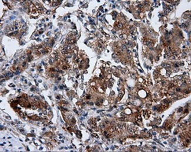 GBE1 Antibody in Immunohistochemistry (Paraffin) (IHC (P))