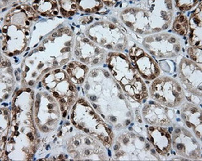 GBE1 Antibody in Immunohistochemistry (Paraffin) (IHC (P))