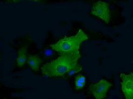 PFKFB4 Antibody in Immunocytochemistry (ICC/IF)