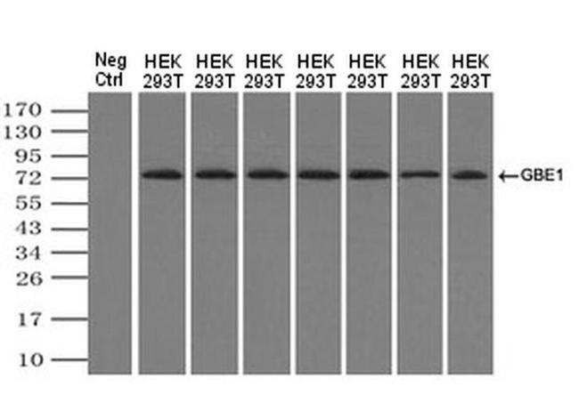 GBE1 Antibody in Western Blot (WB)