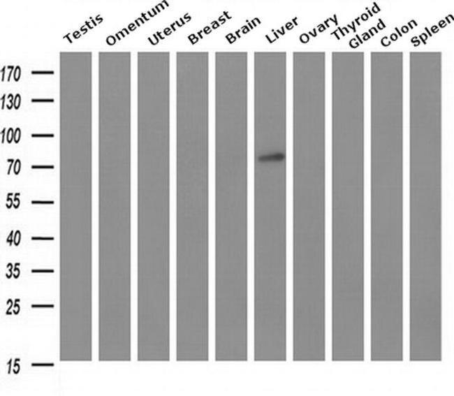 GBE1 Antibody in Western Blot (WB)