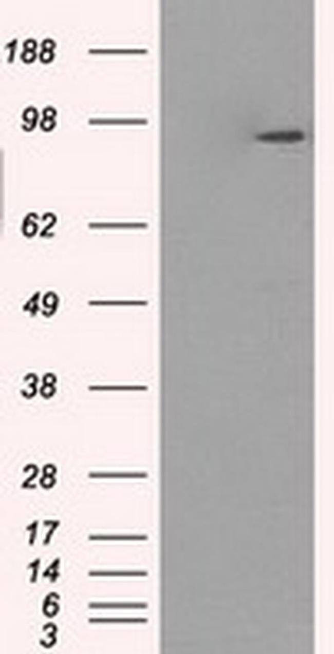 GBE1 Antibody in Western Blot (WB)