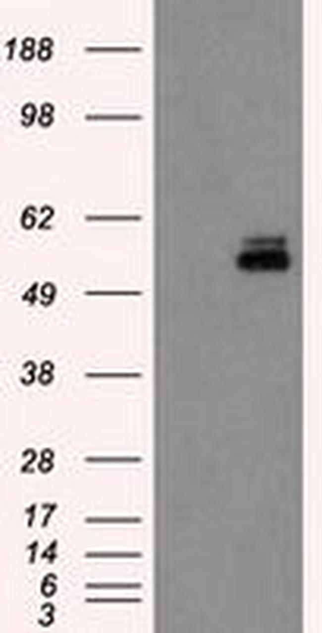 PKMYT1 Antibody in Western Blot (WB)