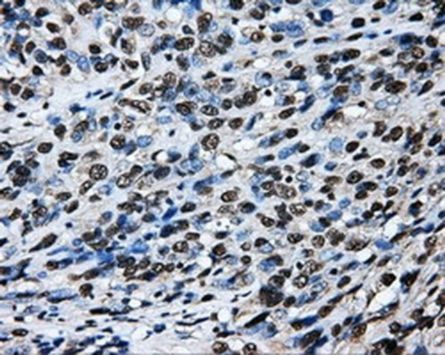 LOX Antibody in Immunohistochemistry (Paraffin) (IHC (P))