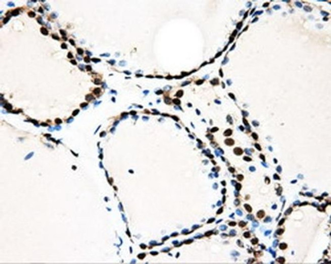 LOX Antibody in Immunohistochemistry (Paraffin) (IHC (P))