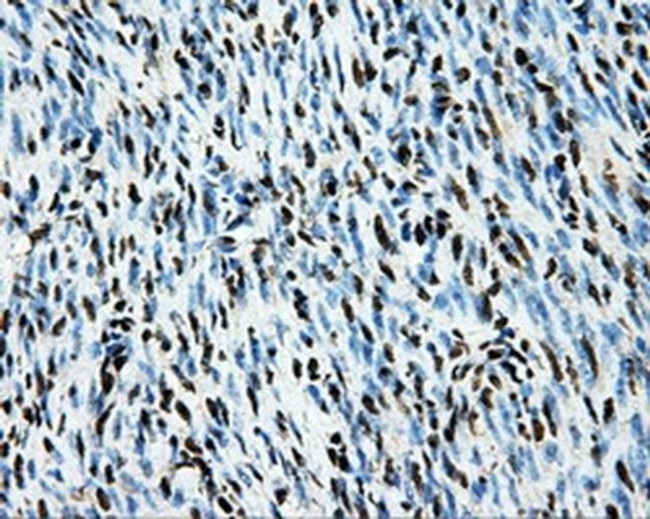 LOX Antibody in Immunohistochemistry (Paraffin) (IHC (P))