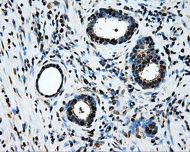 LOX Antibody in Immunohistochemistry (Paraffin) (IHC (P))