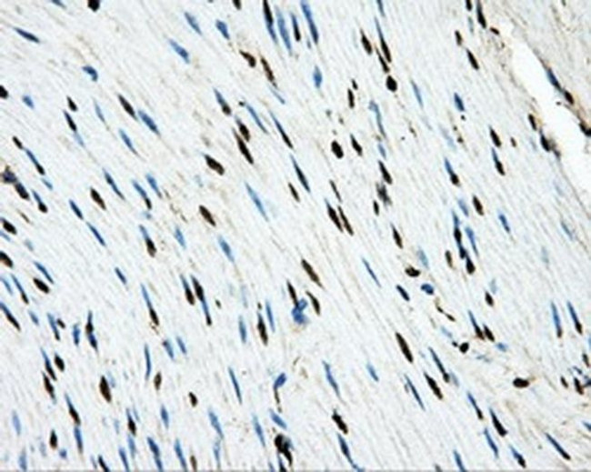 LOX Antibody in Immunohistochemistry (Paraffin) (IHC (P))