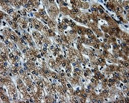 PKMYT1 Antibody in Immunohistochemistry (Paraffin) (IHC (P))