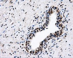 PKMYT1 Antibody in Immunohistochemistry (Paraffin) (IHC (P))