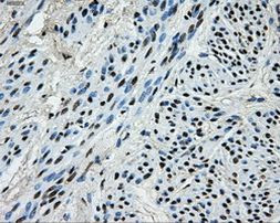 PKMYT1 Antibody in Immunohistochemistry (Paraffin) (IHC (P))