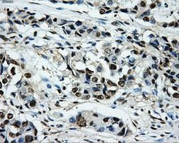 PKMYT1 Antibody in Immunohistochemistry (Paraffin) (IHC (P))