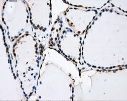 PKMYT1 Antibody in Immunohistochemistry (Paraffin) (IHC (P))