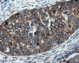 HIPPI Antibody in Immunohistochemistry (Paraffin) (IHC (P))