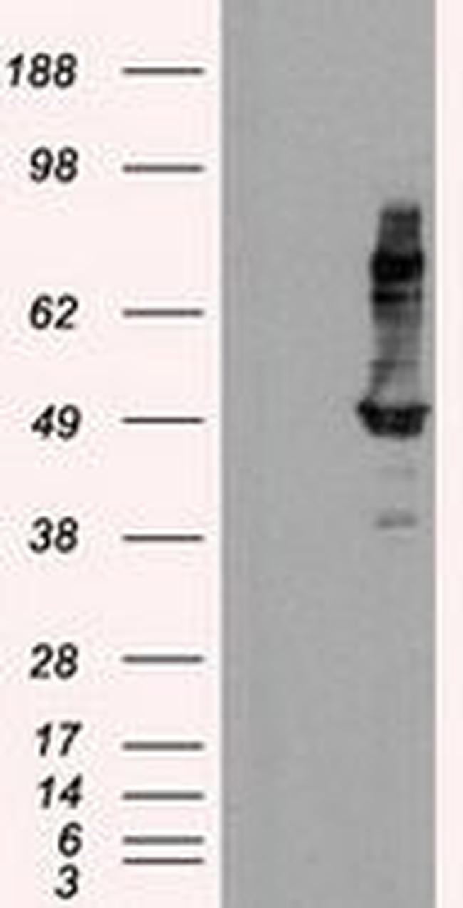 HIPPI Antibody in Western Blot (WB)