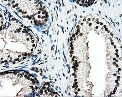 PSMC3 Antibody in Immunohistochemistry (Paraffin) (IHC (P))