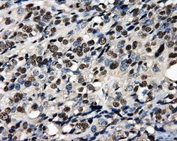 PSMC3 Antibody in Immunohistochemistry (Paraffin) (IHC (P))