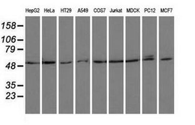 PSMC3 Antibody in Western Blot (WB)