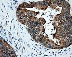 Serine racemase Antibody in Immunohistochemistry (Paraffin) (IHC (P))