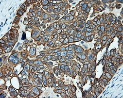 Serine racemase Antibody in Immunohistochemistry (Paraffin) (IHC (P))