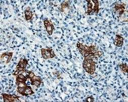 Serine racemase Antibody in Immunohistochemistry (Paraffin) (IHC (P))