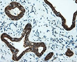 Serine racemase Antibody in Immunohistochemistry (Paraffin) (IHC (P))