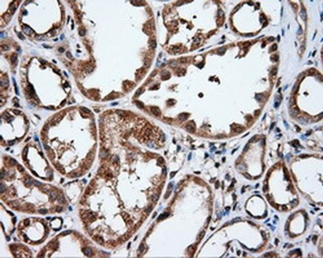 IFIT1 Antibody in Immunohistochemistry (Paraffin) (IHC (P))