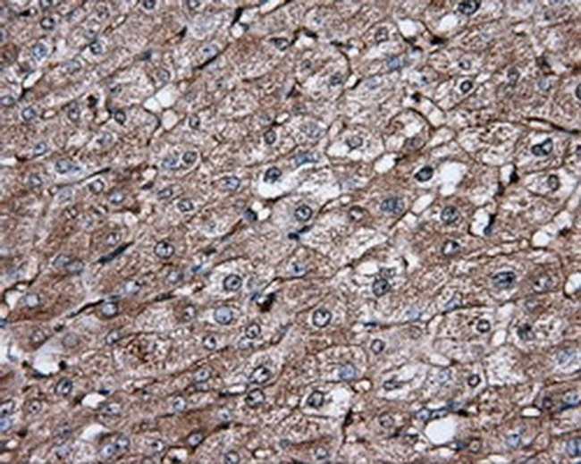 IFIT1 Antibody in Immunohistochemistry (Paraffin) (IHC (P))