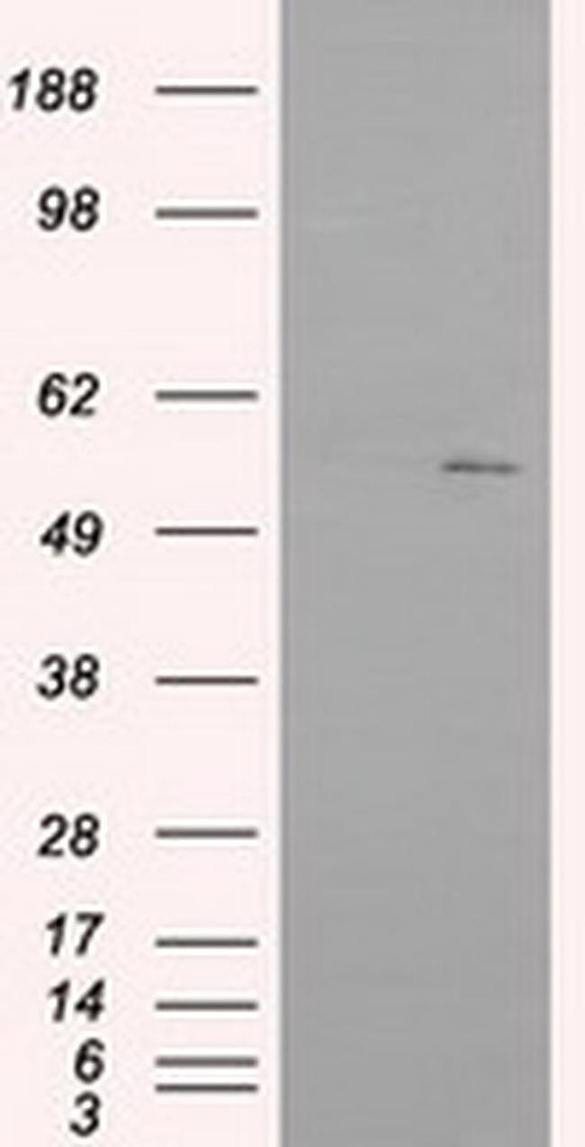 IFIT1 Antibody in Western Blot (WB)