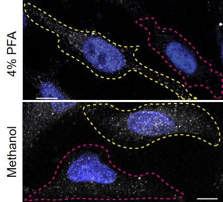 Annexin A11 Antibody in Immunocytochemistry (ICC/IF)