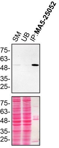 Annexin A11 Antibody in Immunoprecipitation (IP)