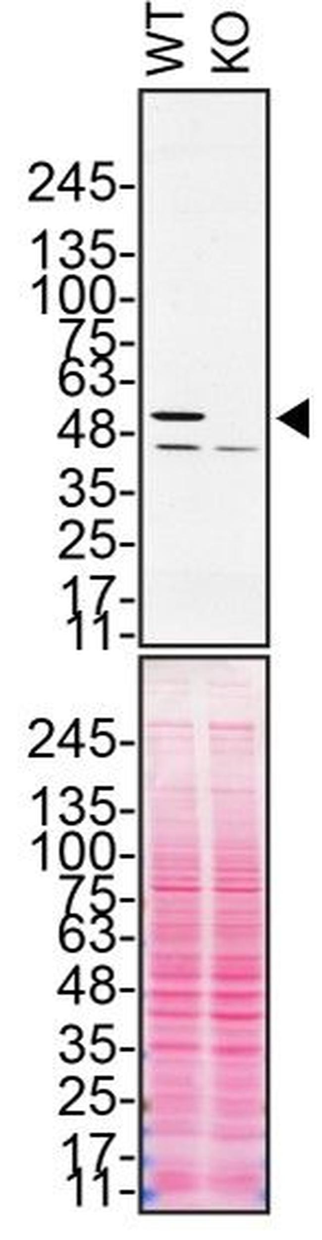 Annexin A11 Antibody in Western Blot (WB)