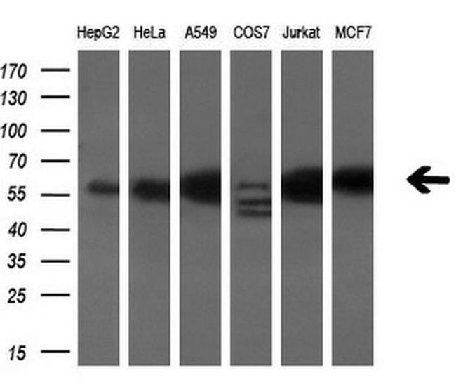 Annexin A11 Antibody in Western Blot (WB)