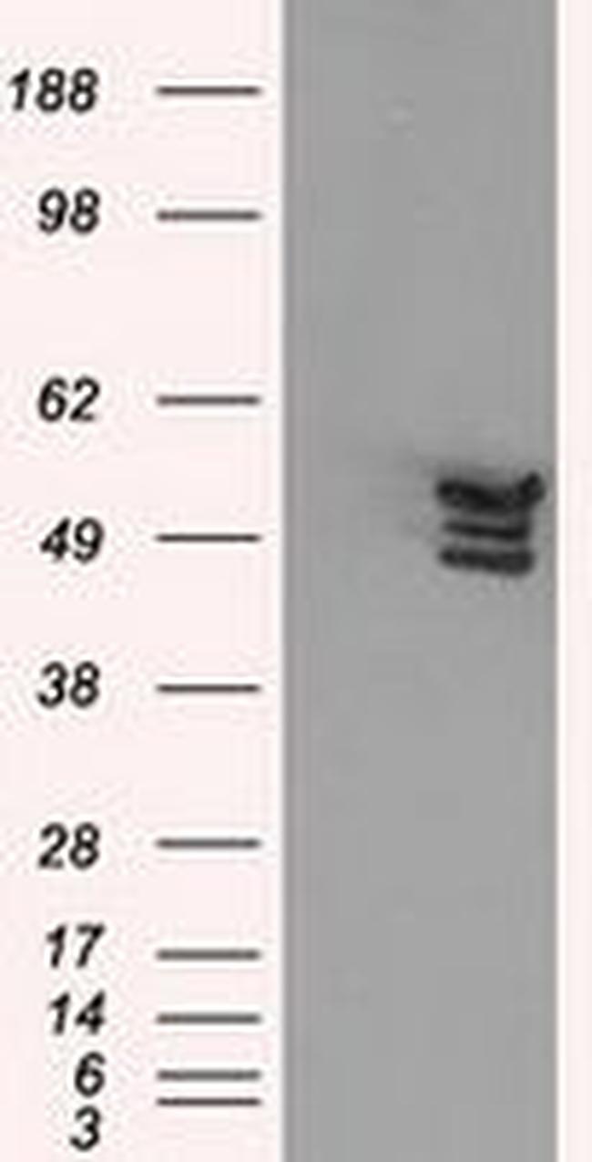 Annexin A11 Antibody in Western Blot (WB)