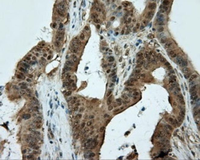 CUGBP1 Antibody in Immunohistochemistry (Paraffin) (IHC (P))