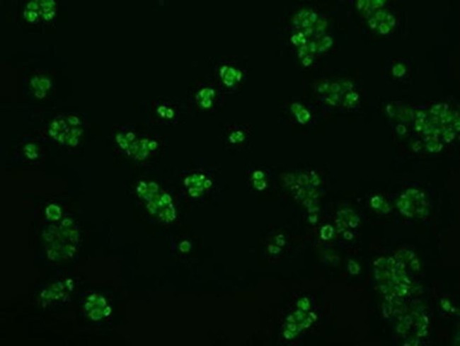 KIAA1609 Antibody in Immunocytochemistry (ICC/IF)