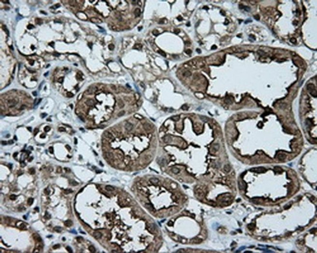 KIAA1609 Antibody in Immunohistochemistry (Paraffin) (IHC (P))