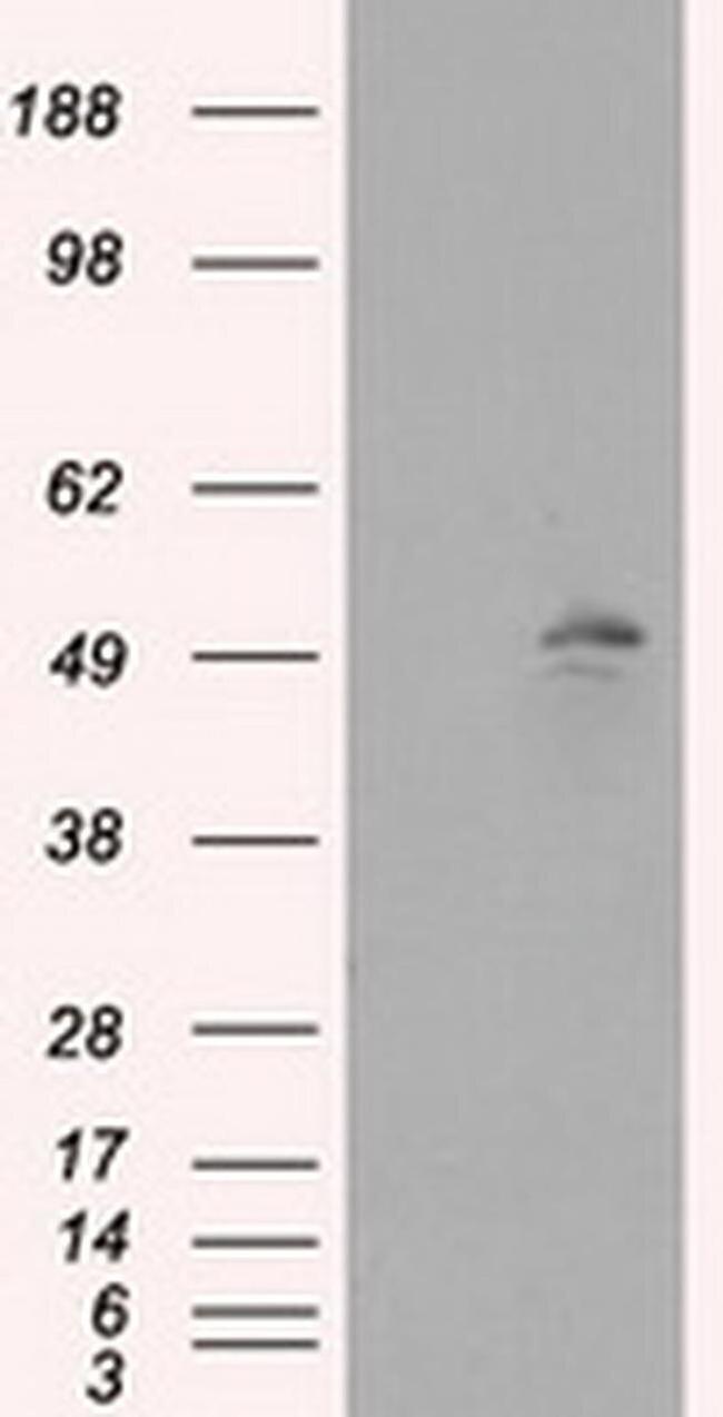 KIAA1609 Antibody in Western Blot (WB)