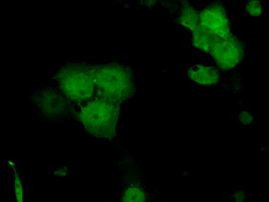 Serine racemase Antibody in Immunocytochemistry (ICC/IF)