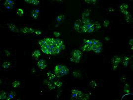 Serine racemase Antibody in Immunocytochemistry (ICC/IF)