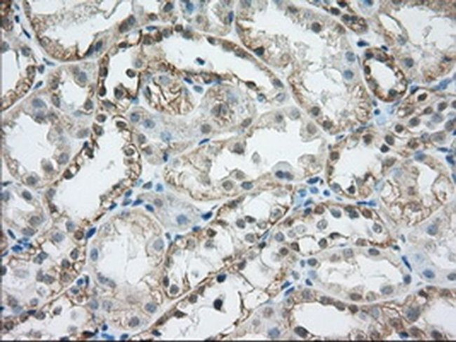 RF1ML Antibody in Immunohistochemistry (Paraffin) (IHC (P))