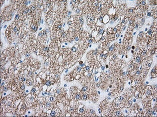 RF1ML Antibody in Immunohistochemistry (Paraffin) (IHC (P))