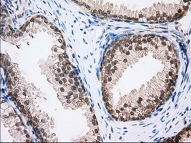 RF1ML Antibody in Immunohistochemistry (Paraffin) (IHC (P))