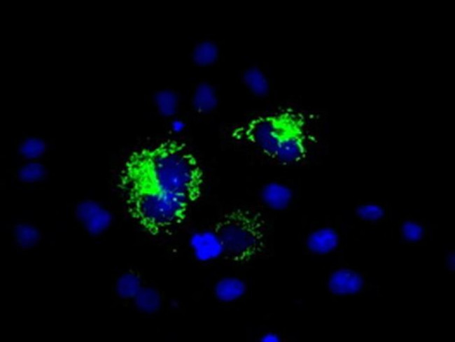 RF1ML Antibody in Immunocytochemistry (ICC/IF)