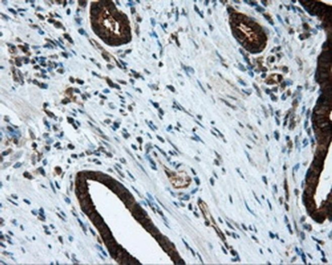 RF1ML Antibody in Immunohistochemistry (Paraffin) (IHC (P))