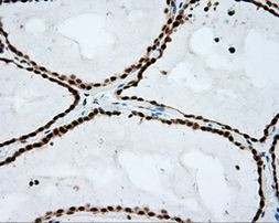 NPR3 Antibody in Immunohistochemistry (Paraffin) (IHC (P))