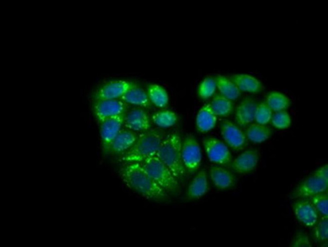 KCTD5 Antibody in Immunocytochemistry (ICC/IF)