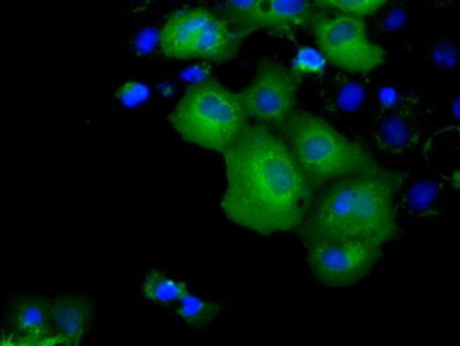 KCTD5 Antibody in Immunocytochemistry (ICC/IF)